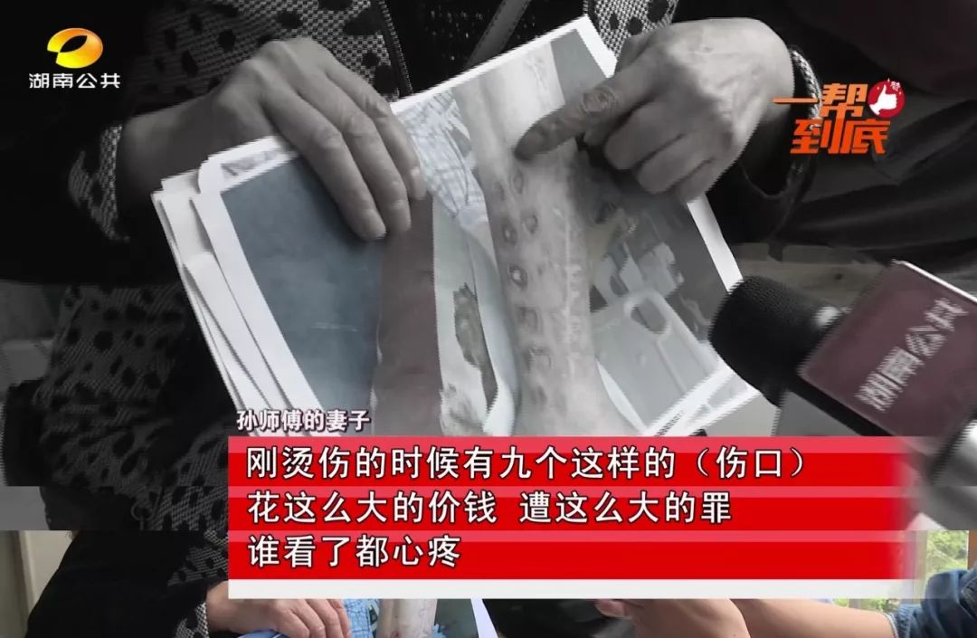第二版